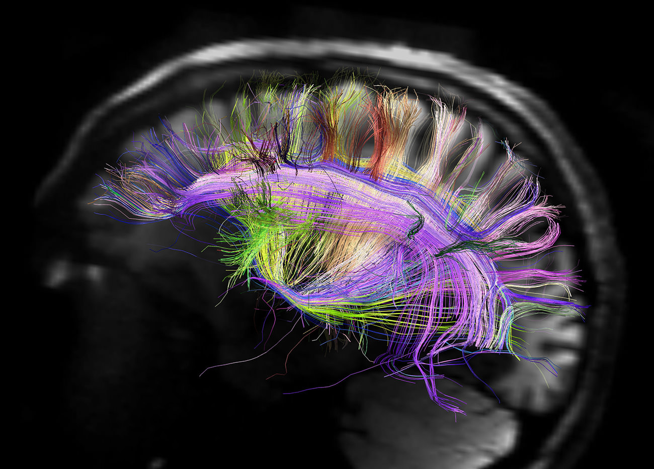 Tipos de contenidos y cómo los procesa el cerebro